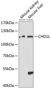 Western blot analysis of extracts of various cell lines using CHD1L Polyclonal Antibody at 1:1000 dilution.