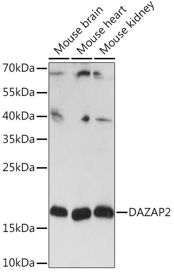 Western blot analysis of extracts of various cell lines using DAZAP2 Polyclonal Antibody at1:3000 dilution.