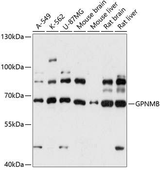 Western blot analysis of extracts of various cell lines using GPNMB Polyclonal Antibody at 1:3000 dilution.