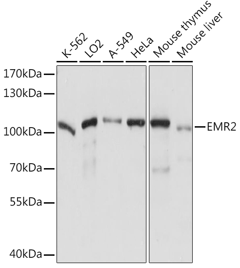 Western blot analysis of extracts of various cell lines using EMR2 Polyclonal Antibody at1:1000 dilution.