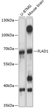 Western blot analysis of extracts of various cell lines using FLAD1 Polyclonal Antibody at 1:3000 dilution.