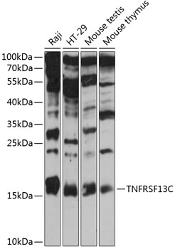 Western blot analysis of extracts of various cell lines using TNFRSF13C Polyclonal Antibody at 1:3000 dilution.