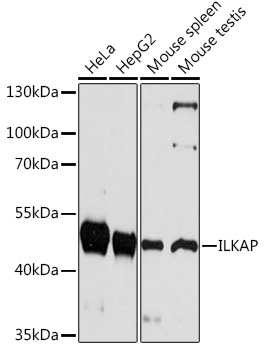 Western blot analysis of extracts of various cell lines using ILKAP Polyclonal Antibody at1:1000 dilution.