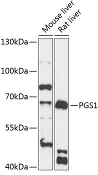 Western blot analysis of extracts of various cell lines using PGS1 Polyclonal Antibody at 1:3000 dilution.