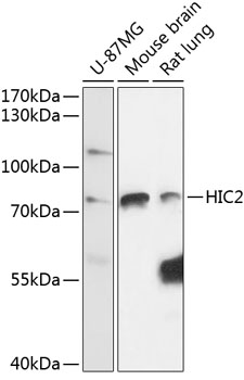 Western blot analysis of extracts of various cell lines using HIC2 Polyclonal Antibody at 1:3000 dilution.