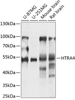 Western blot analysis of extracts of various cell lines using HTRA4 Polyclonal Antibody at 1:1000 dilution.