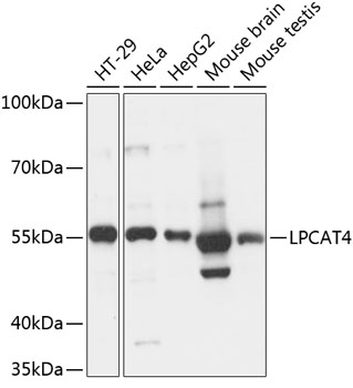 Western blot analysis of extracts of various cell lines using LPCAT4 Polyclonal Antibody at 1:3000 dilution.