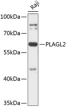 Western blot analysis of extracts of Raji cells using PLAGL2 Polyclonal Antibody at 1:3000 dilution.