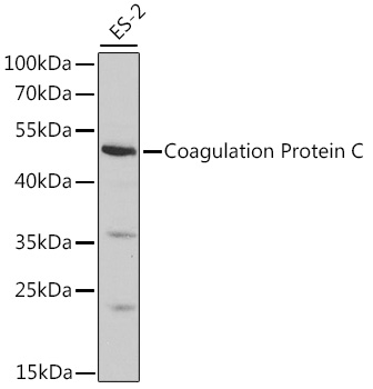 Western blot analysis of extracts of ES-2 cells using Coagulation Protein C Polyclonal Antibody at 1:1000 dilution.