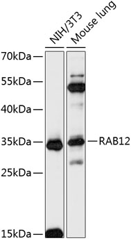 Western blot analysis of extracts of various cell lines using RAB12 Polyclonal Antibody at 1:3000 dilution.