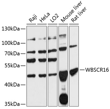 Western blot analysis of extracts of various cell lines using WBSCR16 Polyclonal Antibody at 1:3000 dilution.