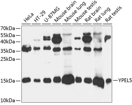 Western blot analysis of extracts of various cell lines using YPEL5 Polyclonal Antibody at 1:3000 dilution.