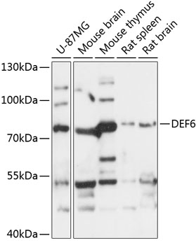 Western blot analysis of extracts of various cell lines using DEF6 Polyclonal Antibody at 1:3000 dilution.