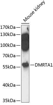 Western blot analysis of extracts of mouse kidney using DMRTA1 Polyclonal Antibody at 1:3000 dilution.