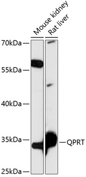 Western blot analysis of extracts of various cell lines using QPRT Polyclonal Antibody at 1:3000 dilution.