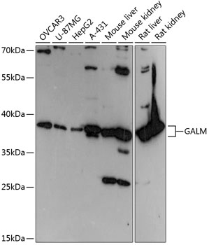 Western blot analysis of extracts of various cell lines using GALM Polyclonal Antibody at 1:3000 dilution.