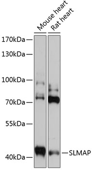 Western blot analysis of extracts of various cell lines using SLMAP Polyclonal Antibody at 1:3000 dilution.