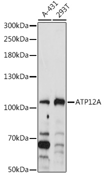 Western blot analysis of extracts of various cell lines using ATP12A Polyclonal Antibody at 1:1000 dilution.