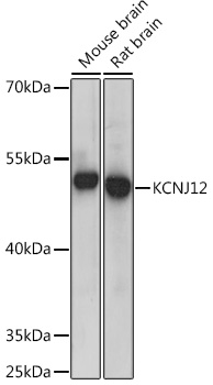 Western blot analysis of extracts of various cell lines using KCNJ12 Polyclonal Antibody at1:300 dilution.