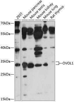 Western blot analysis of extracts of various cell lines using OVOL1 Polyclonal Antibody at 1:1000 dilution.