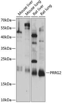 Western blot analysis of extracts of various cell lines using PRRG2 Polyclonal Antibody at 1:1000 dilution.