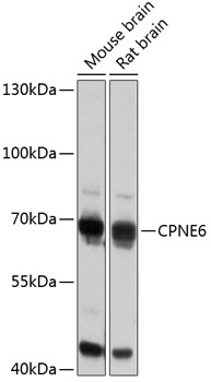 Western blot analysis of extracts of various cell lines using CPNE6 Polyclonal Antibody at 1:3000 dilution.