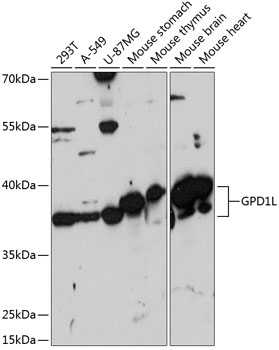 Western blot analysis of extracts of various cell lines using GPD1L Polyclonal Antibody at 1:3000 dilution.