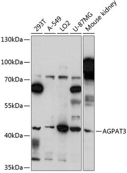 Western blot analysis of extracts of various cell lines using AGPAT3 Polyclonal Antibody at 1:3000 dilution.