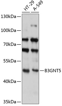 Western blot analysis of extracts of various cell lines using B3GNT5 Polyclonal Antibody at 1:3000 dilution.