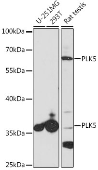 Western blot analysis of extracts of various cell lines using PLK5 Polyclonal Antibody at 1:1000 dilution.