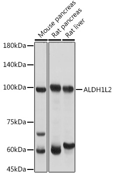 Western blot analysis of extracts of various cell lines using ALDH1L2 Polyclonal Antibody at 1:3000 dilution.