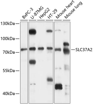 Western blot analysis of extracts of various cell lines using SLC37A2 Polyclonal Antibody at 1:3000 dilution.