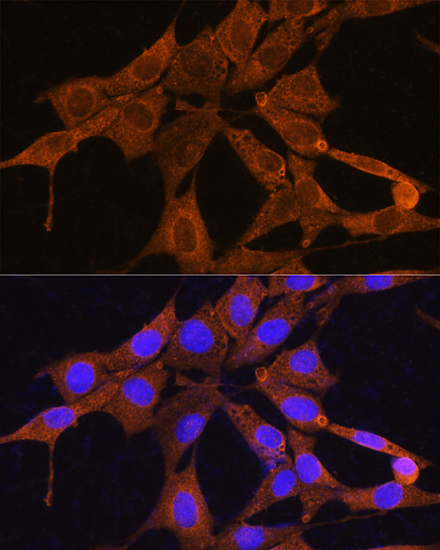 Immunofluorescence analysis of NIH/3T3 cells using NMNAT3 Polyclonal Antibody at dilution of 1:100. Blue: DAPI for nuclear staining.