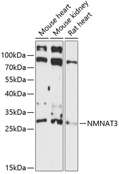 Western blot analysis of extracts of various cell lines using NMNAT3 Polyclonal Antibody at 1:3000 dilution.