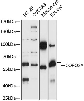 Western blot analysis of extracts of various cell lines using CORO2A Polyclonal Antibody at 1:1000 dilution.