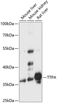 Western blot analysis of extracts of various cell lines using TTPA Polyclonal Antibody at 1:3000 dilution.