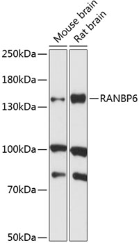 Western blot analysis of extracts of various cell lines using RANBP6 Polyclonal Antibody at 1:1000 dilution.