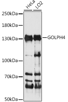 Western blot analysis of extracts of various cell lines using GOLPH4 Polyclonal Antibody at 1:1000 dilution.