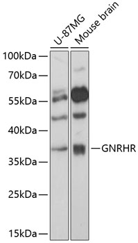 Western blot analysis of extracts of various cell lines using GNRHR Polyclonal Antibody at 1:3000 dilution.