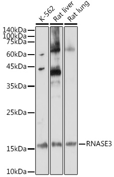 Western blot analysis of extracts of various cell lines using RNASE3 Polyclonal Antibody at 1:1000 dilution.