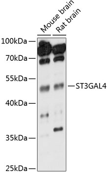 Western blot analysis of Mouse liver using ST3GAL4 Polyclonal Antibody at 1:1000 dilution.