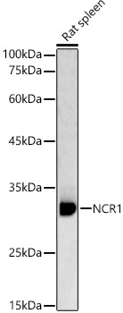 Western blot analysis of Rat spleen using NCR1 Polyclonal Antibody at 1:1000 dilution.