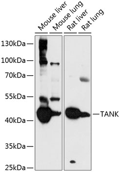Western blot analysis of extracts of various cell lines using TANK Polyclonal Antibody at 1:3000 dilution.