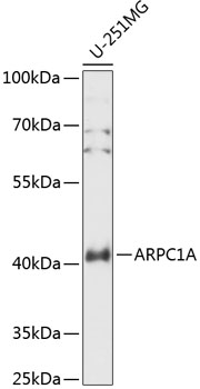 Western blot analysis of extracts of U-251MG cells using ARPC1A Polyclonal Antibody at 1:3000 dilution.