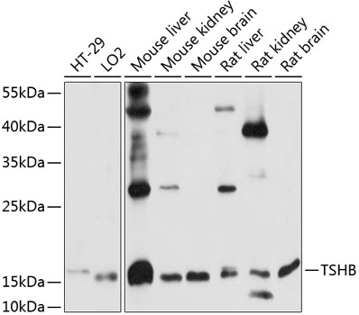 Western blot analysis of extracts of various cell lines using TSHB Polyclonal Antibody at 1:1000 dilution.