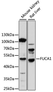 Western blot analysis of extracts of various cell lines using FUCA1 Polyclonal Antibody at 1:1000 dilution.