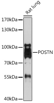 Western blot analysis of extracts of Rat lung using POSTN Polyclonal Antibody at 1:1000 dilution.