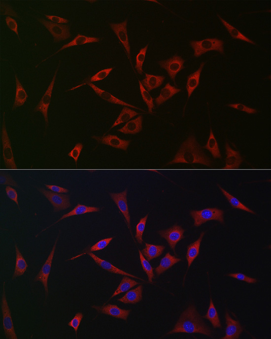 Immunofluorescence analysis of NIH/3T3 cells using [KO Validated] PHD2/EGLN1 Polyclonal Antibody at dilution of 1:100 (40x lens). Blue: DAPI for nuclear staining.