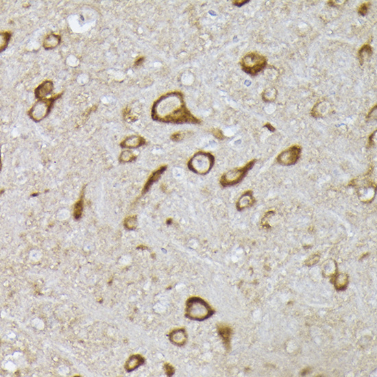 Immunohistochemistry of paraffin-embedded mouse brain using [KO Validated] PHD2/EGLN1 Polyclonal Antibody at dilution of 1:100 (40x lens).Perform high pressure antigen retrieval with 10 mM citrate buffer pH 6.0 before commencing with IHC staining protocol.