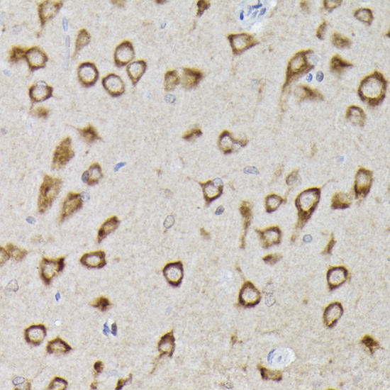 Immunohistochemistry of paraffin-embedded rat brain using [KO Validated] PHD2/EGLN1 Polyclonal Antibody at dilution of 1:100 (40x lens).Perform high pressure antigen retrieval with 10 mM citrate buffer pH 6.0 before commencing with IHC staining protocol.